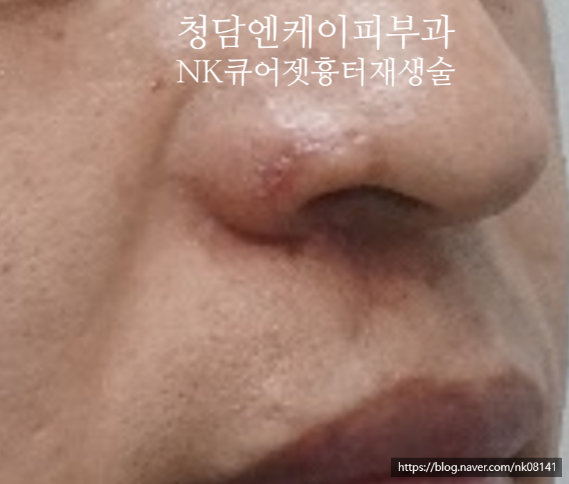 청담엔케이피부과청담NK피부과 이미지