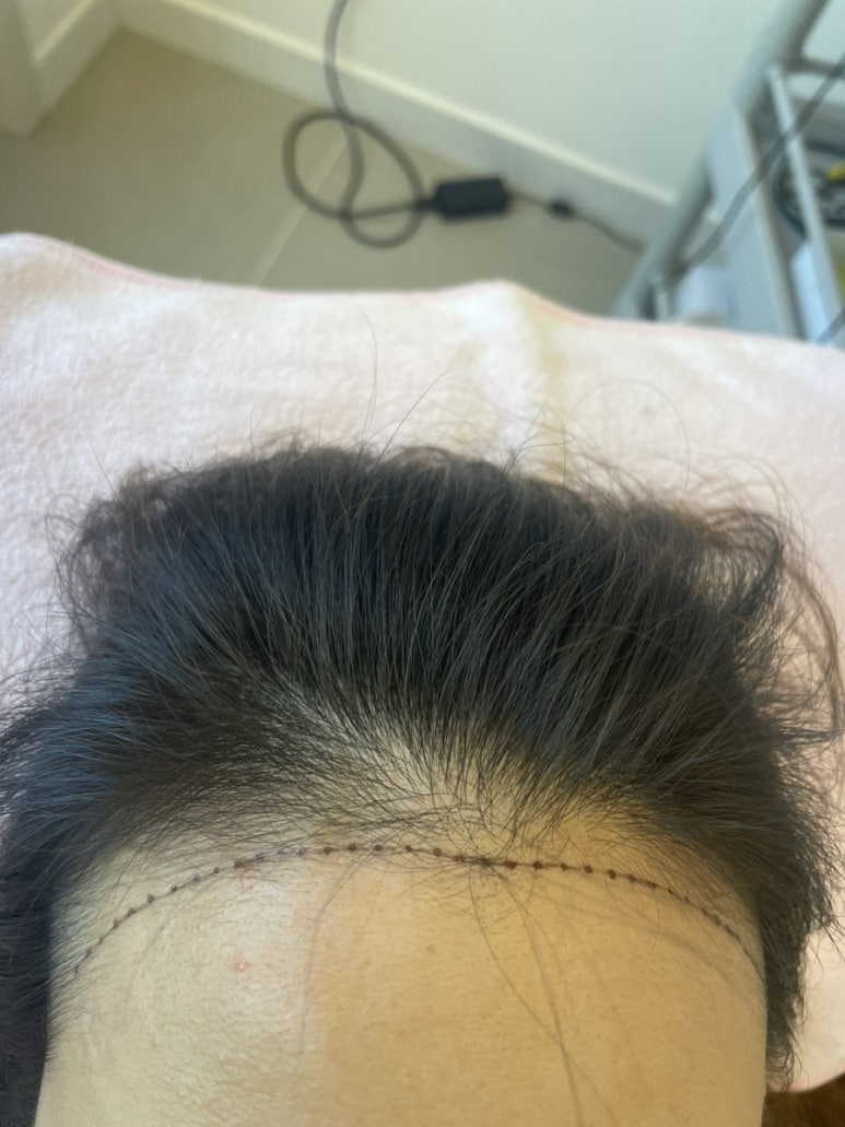 헤어끌리네 이미지