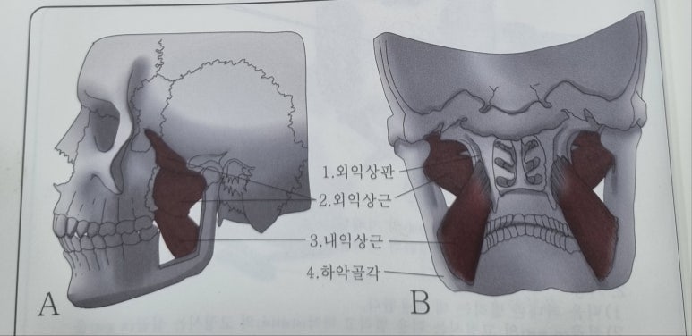 라파케어 이미지