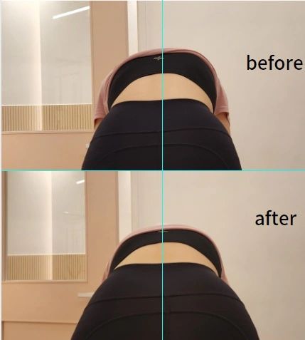 코멜리 이미지