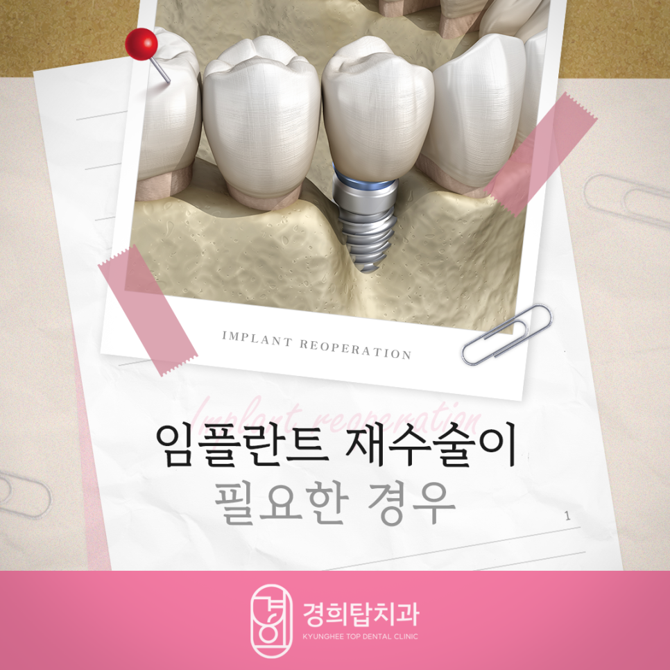 경희탑치과의원 이미지