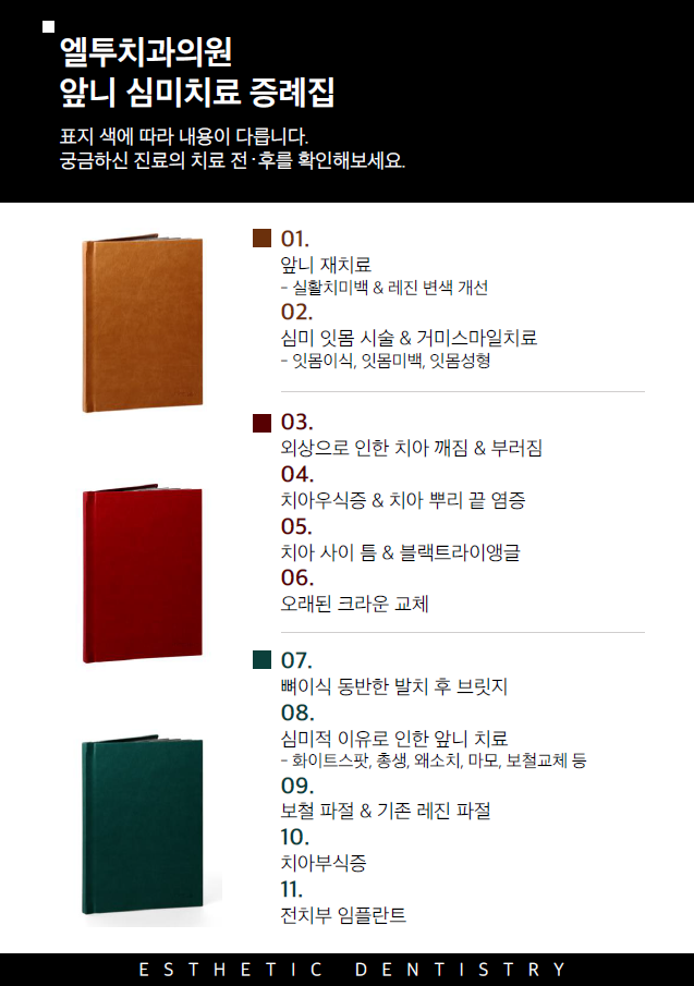엘투 이미지