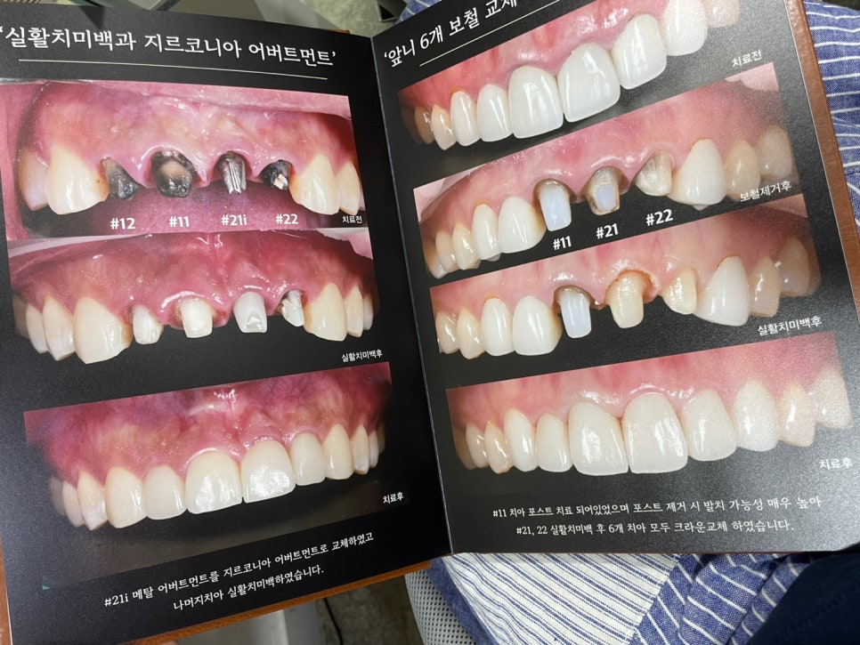 엘투 이미지