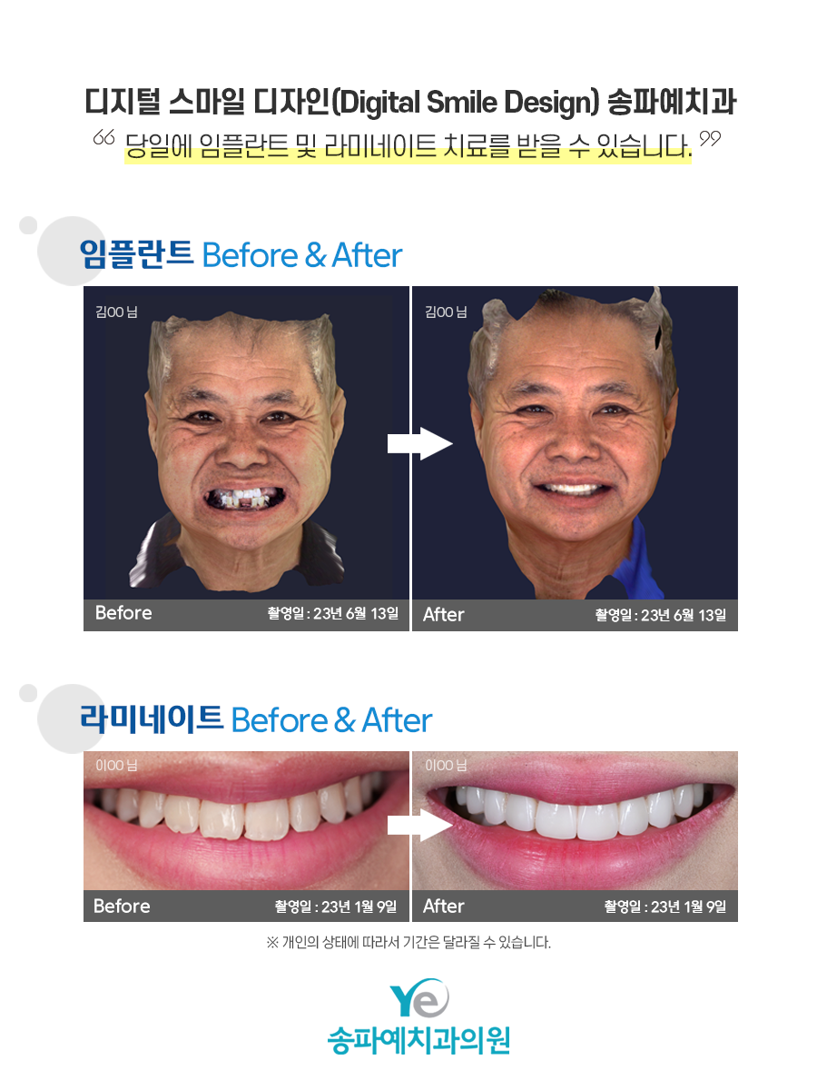 송파예치과 이미지