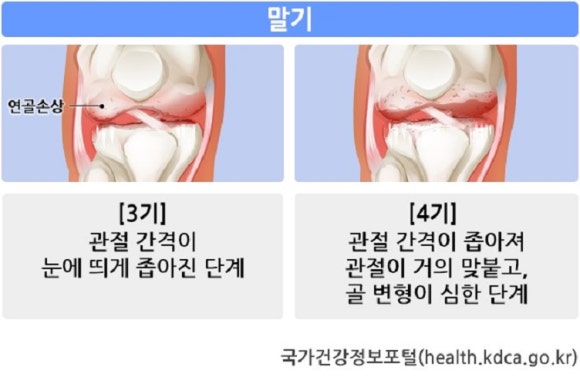 운동생활 이미지