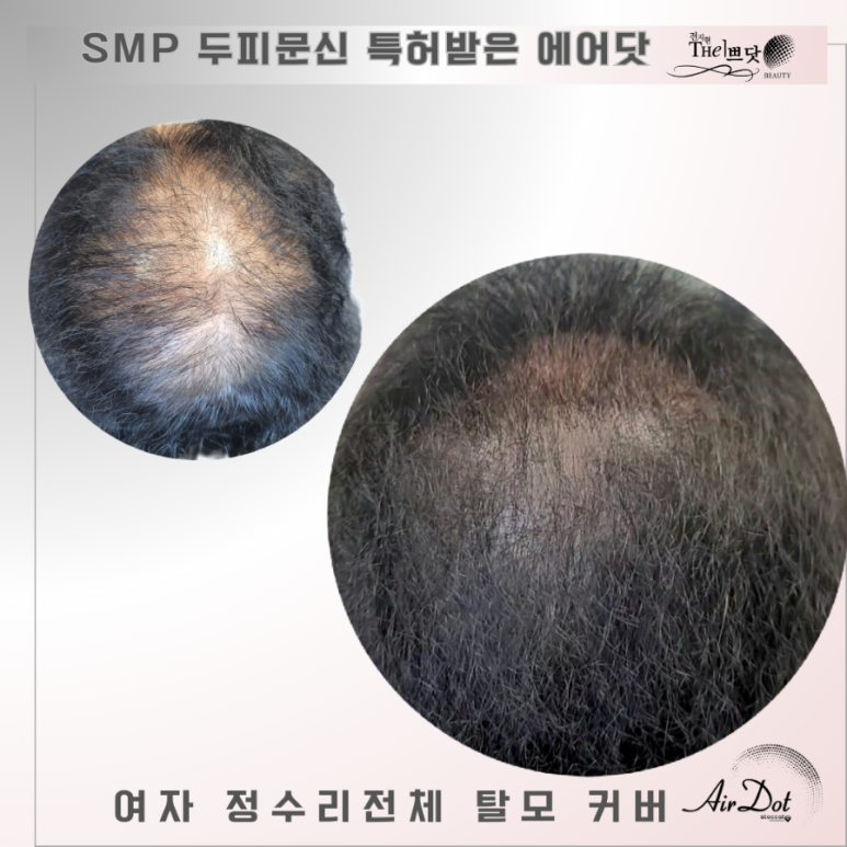 the 예뻐지러 이미지