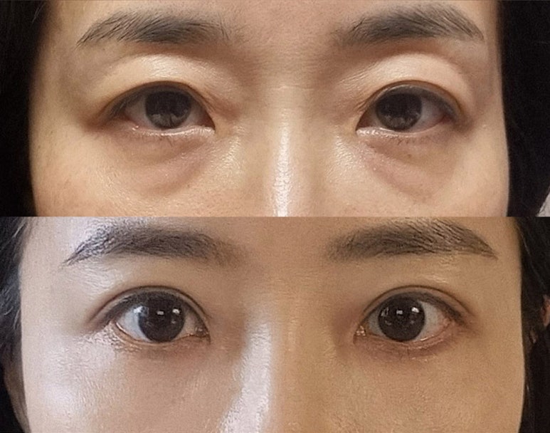 YES성형외과의원 이미지