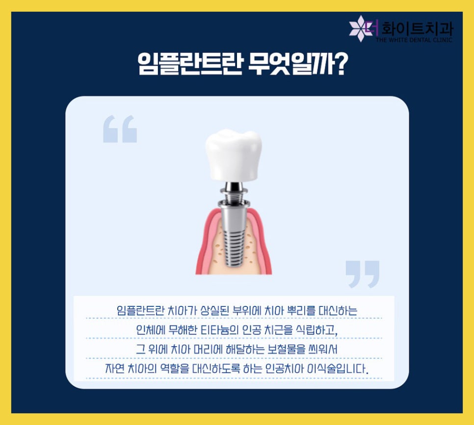 더화이트치과 이미지