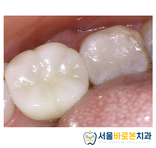 김의치과 이미지