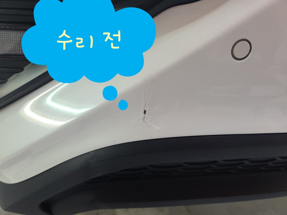 제일덴트칼라시스템 이미지