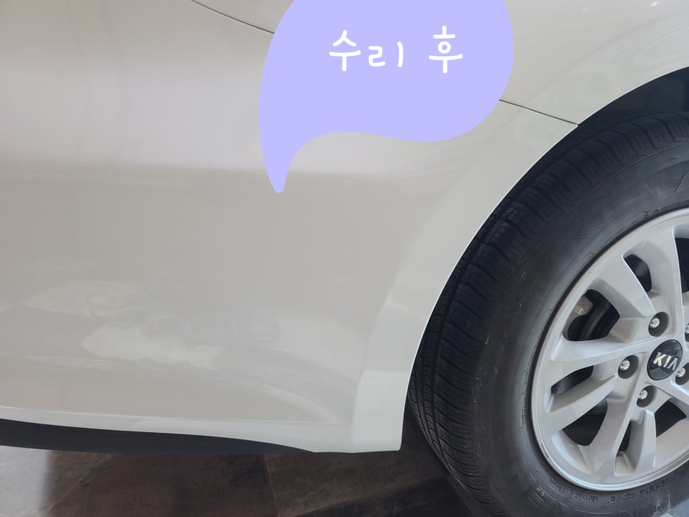 제일덴트칼라시스템 이미지