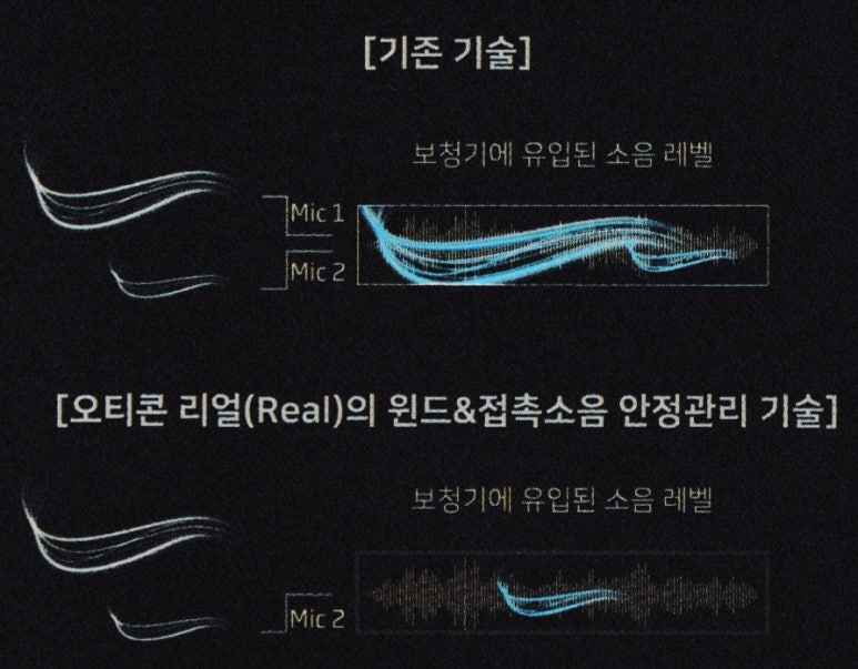 독일보청기 진영센터 이미지