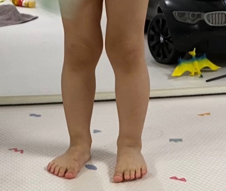 서울이음정형외과 이미지