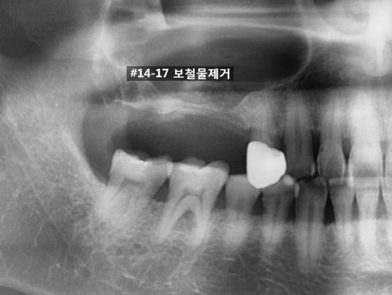 연세그랜드치과 이미지