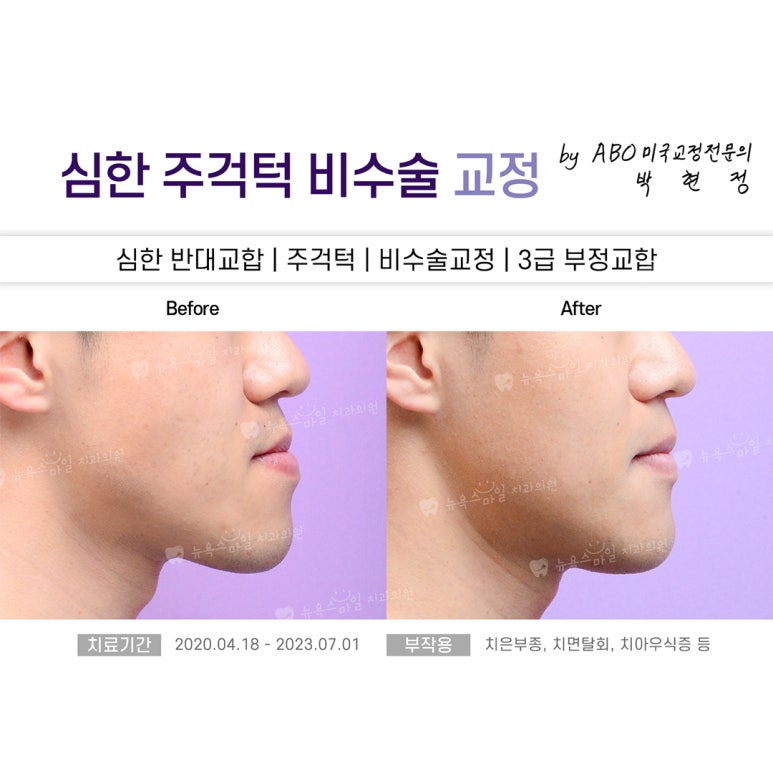 서면뉴욕치과의원 이미지