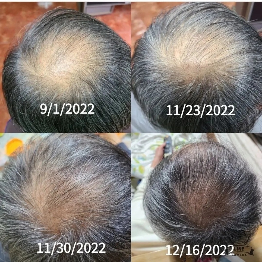 헤어큐 이미지
