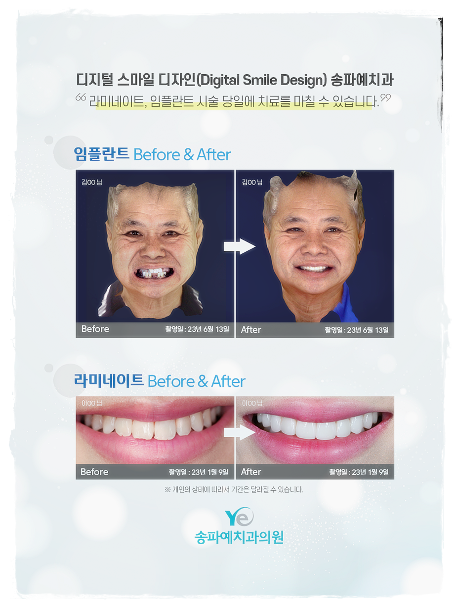 송파예치과 이미지