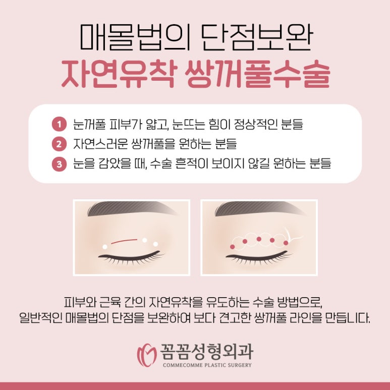 꼼꼼성형외과의원 이미지