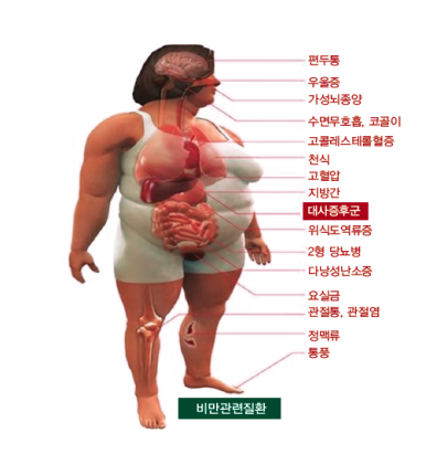 리얼클린족욕 이미지