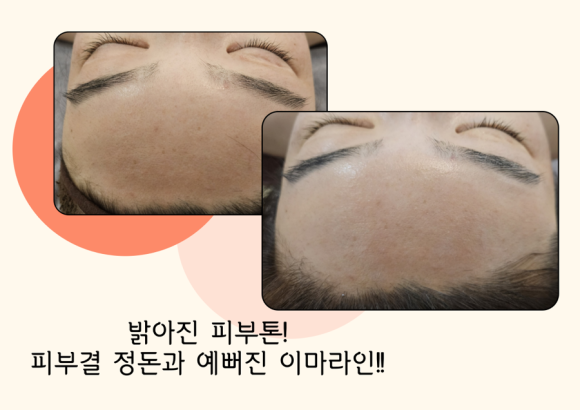 숲칼프 동대구역점 이미지