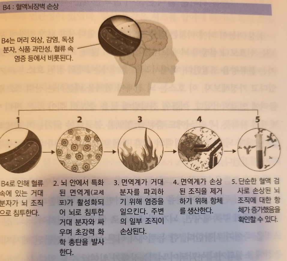 네오Brain 이미지