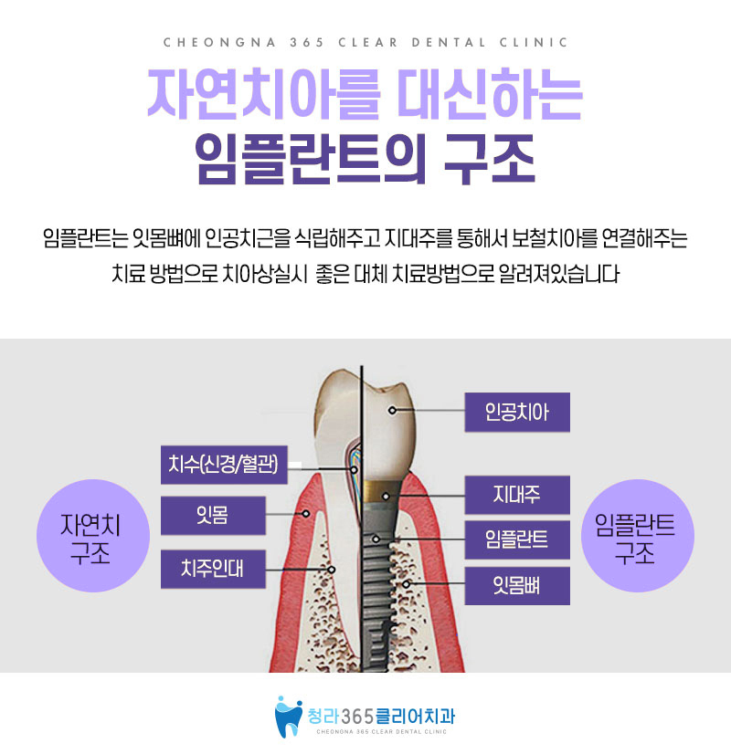 시티치과 이미지
