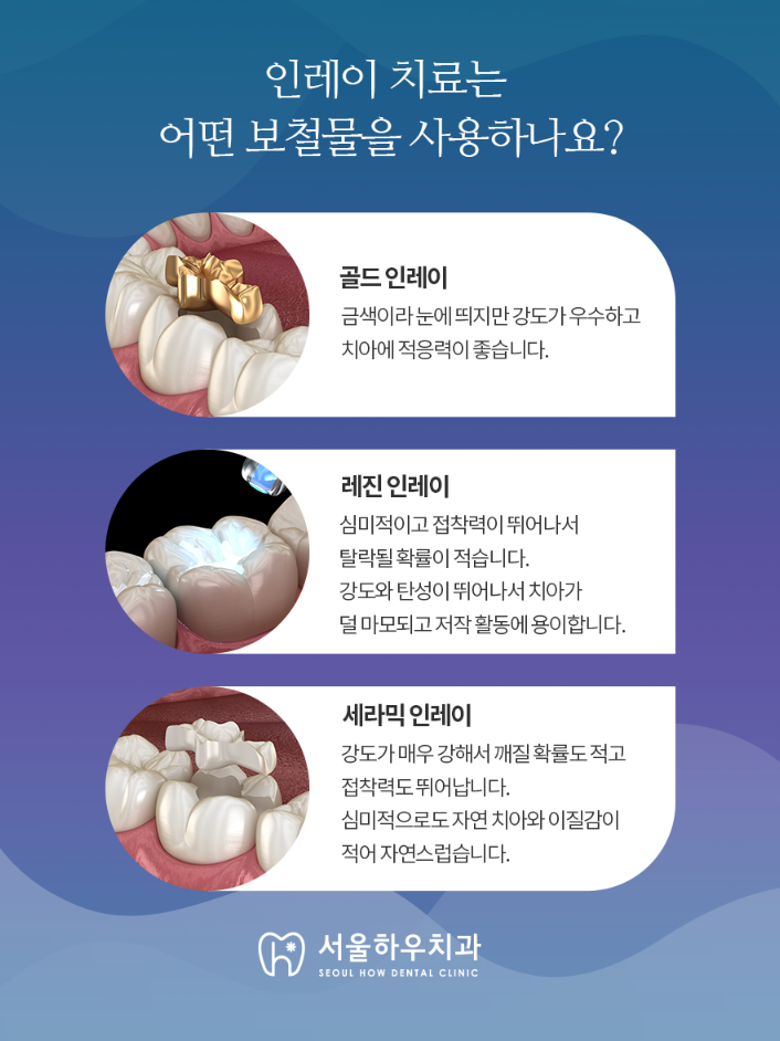서울하우치과 이미지
