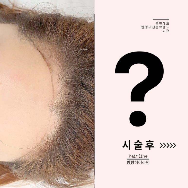 바다헤어라인 이미지