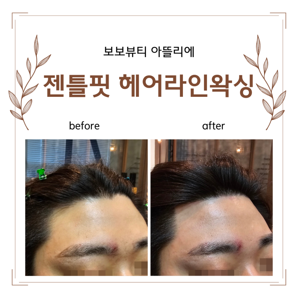 그남자왁싱 이미지