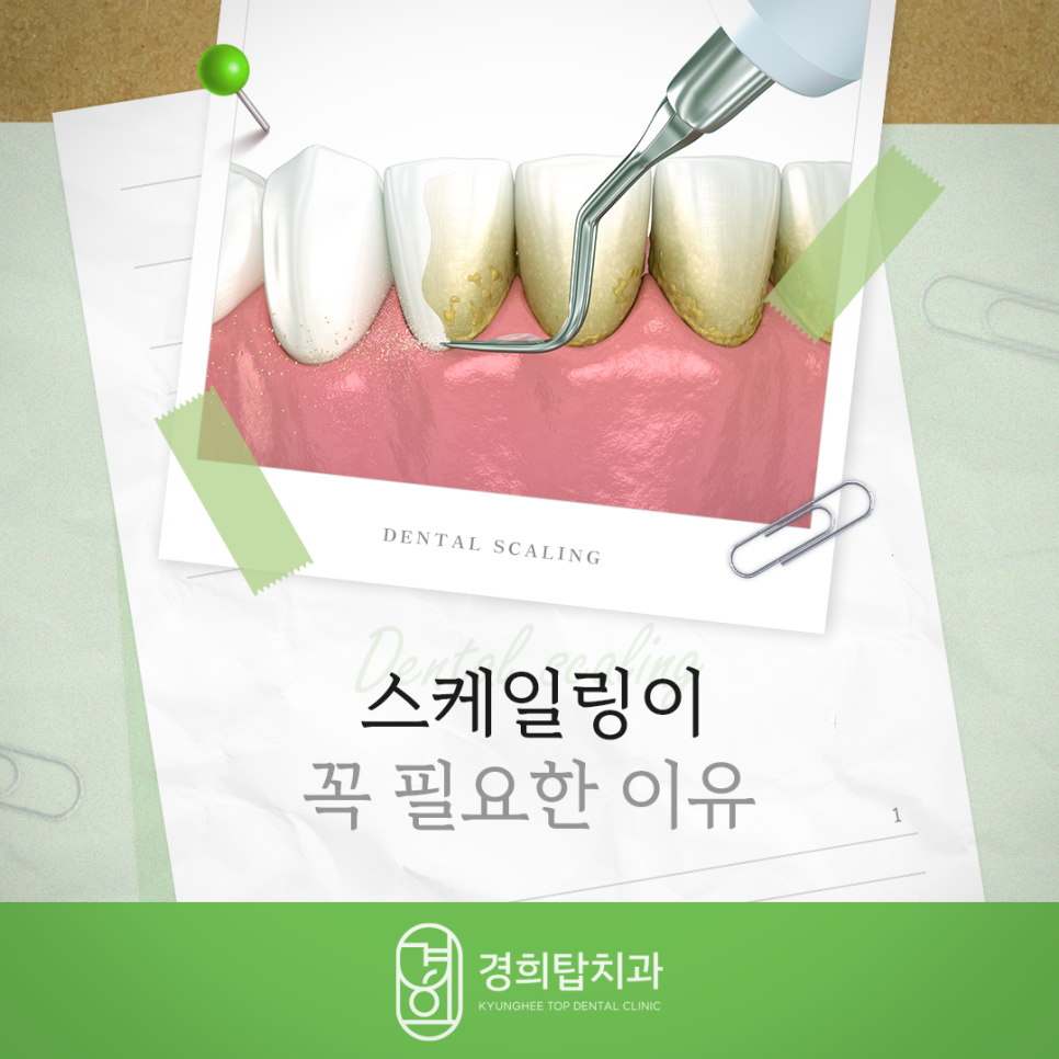 경희탑치과의원 이미지