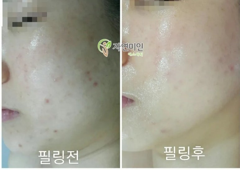 데코텍 이미지