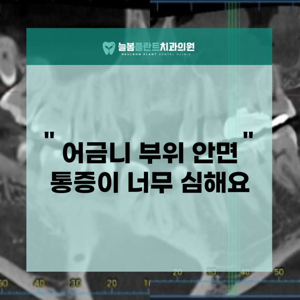 늘봄플란트치과 이미지