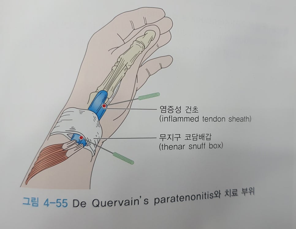 최수용한의원 이미지