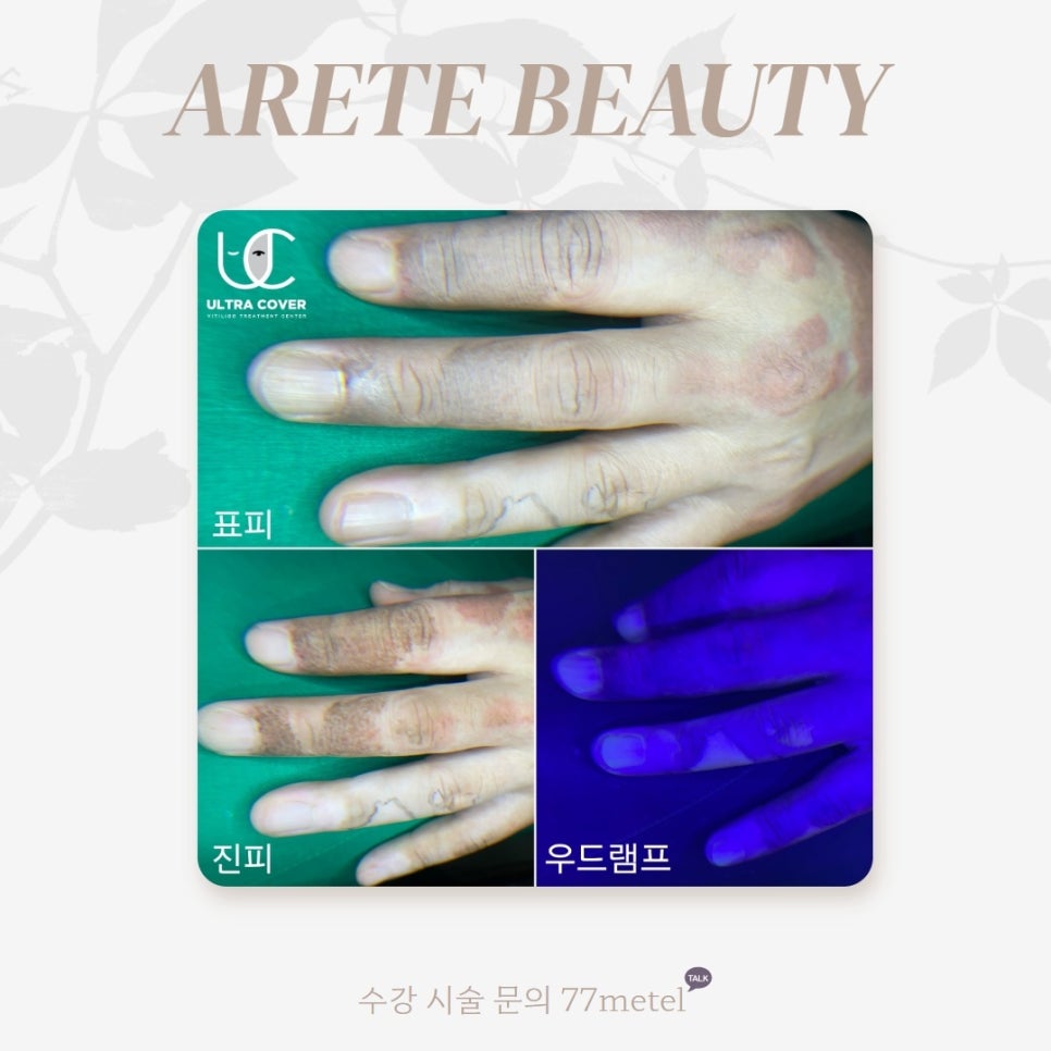 52아레테 이미지