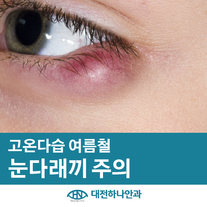 대전하나안과의원 이미지