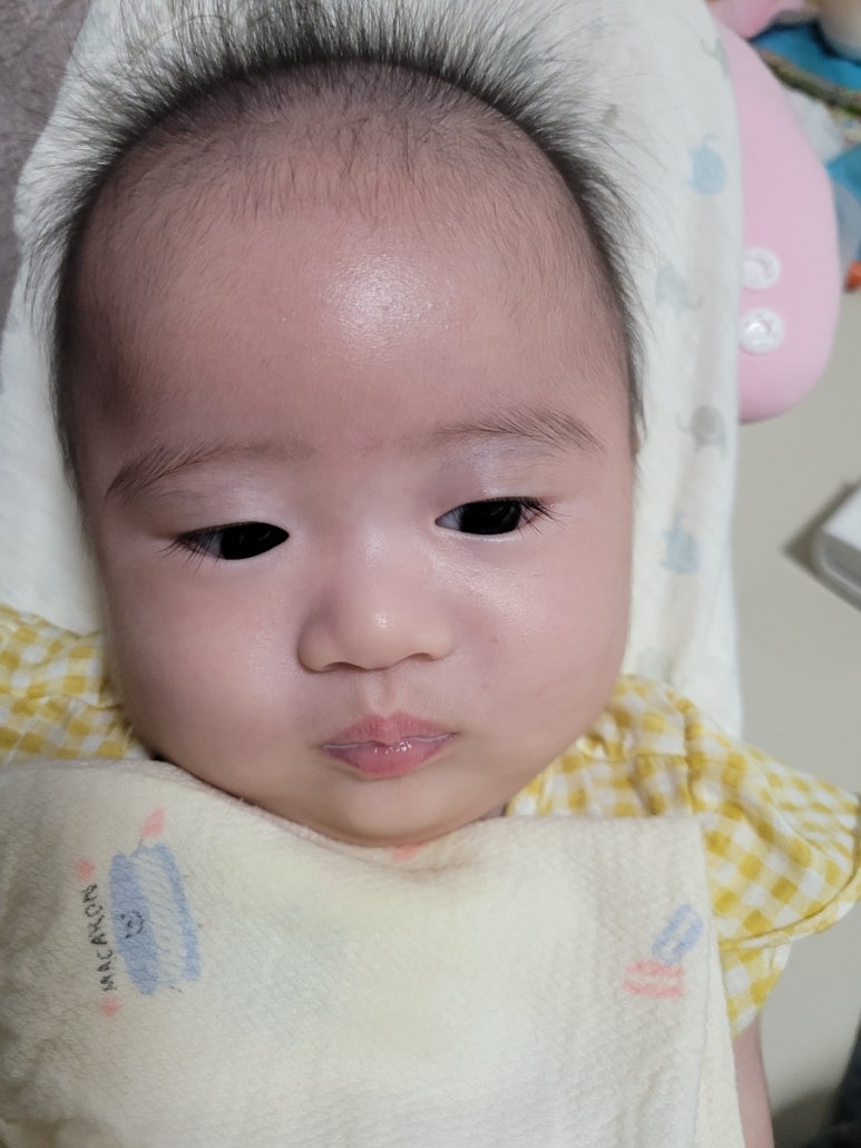 애기피부1호 이미지