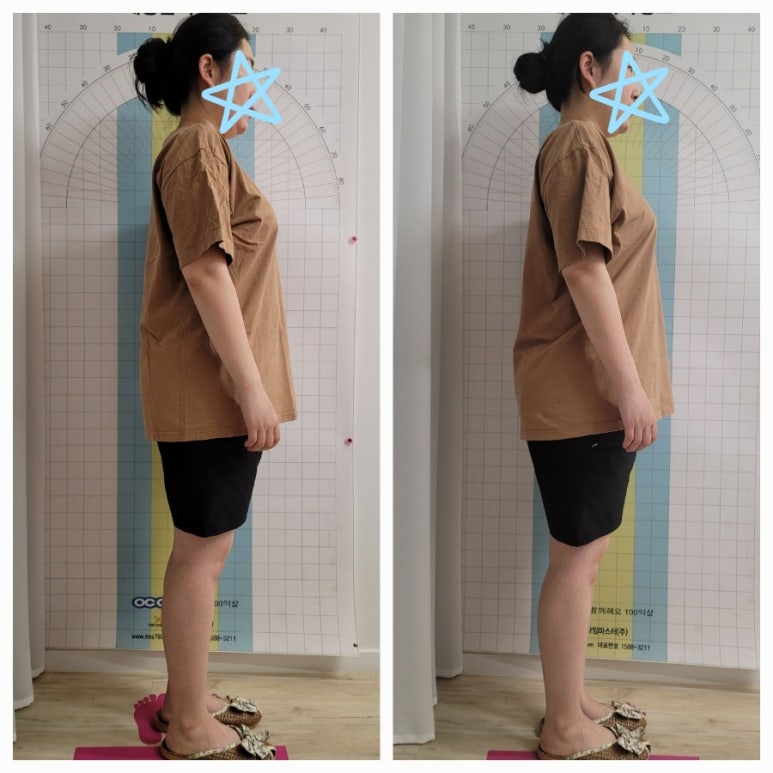 씨씨체형관리 이미지