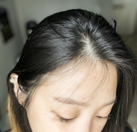 뽀송크리닉 이미지