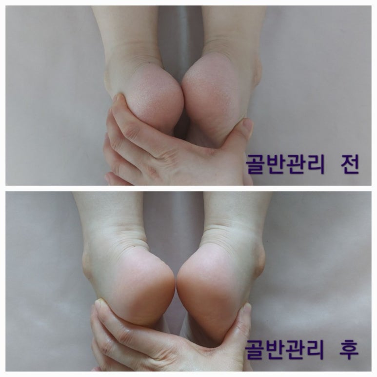 김포출장마사지 이미지