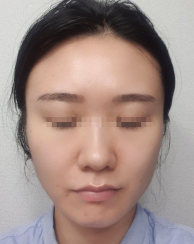 휴코스메틱 이미지