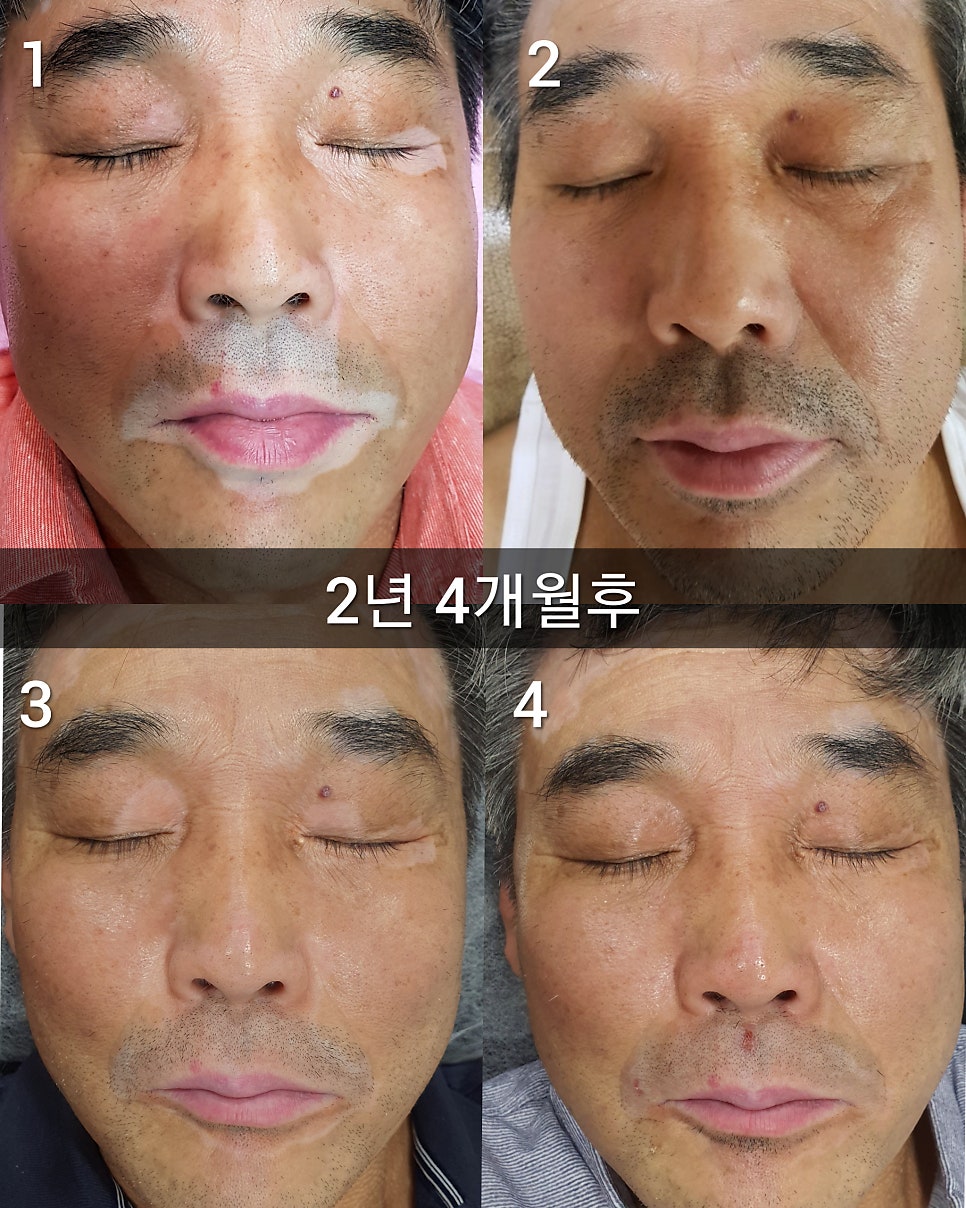 52아레테 이미지