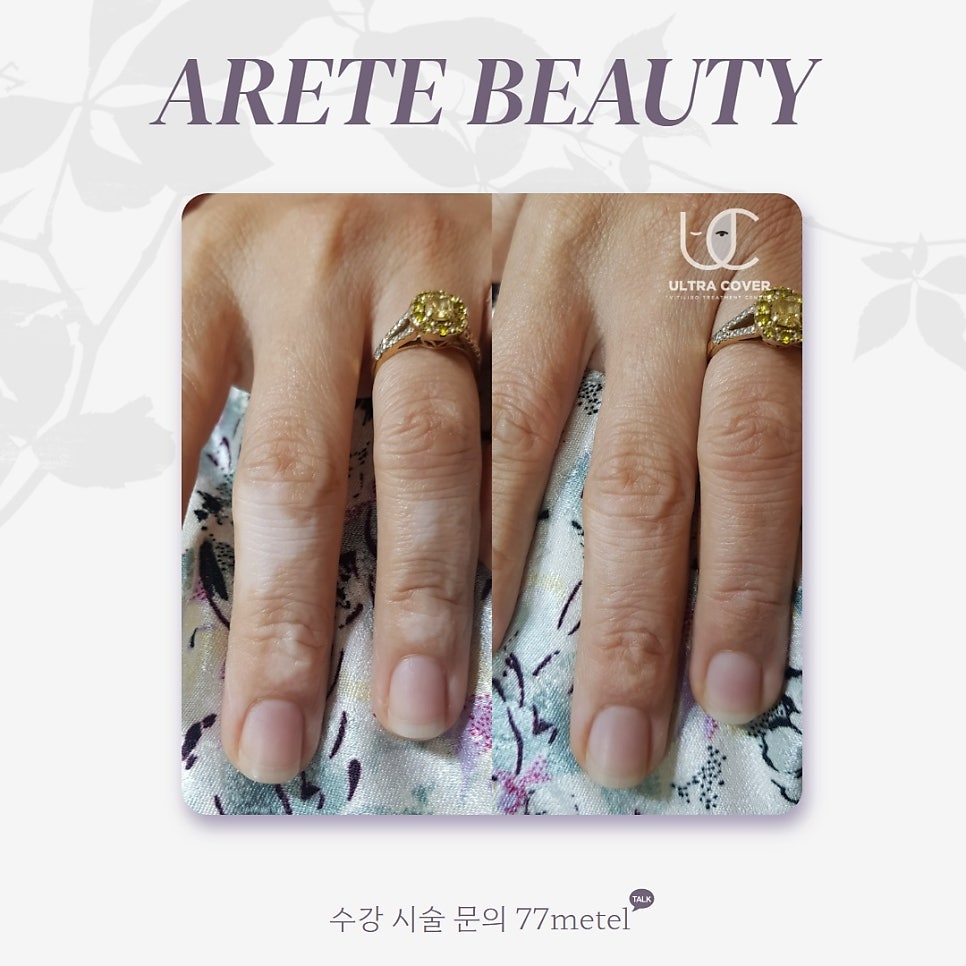 52아레테 이미지