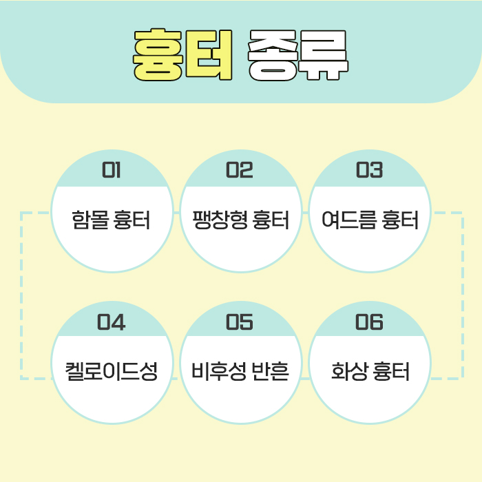 수두피케어 이미지