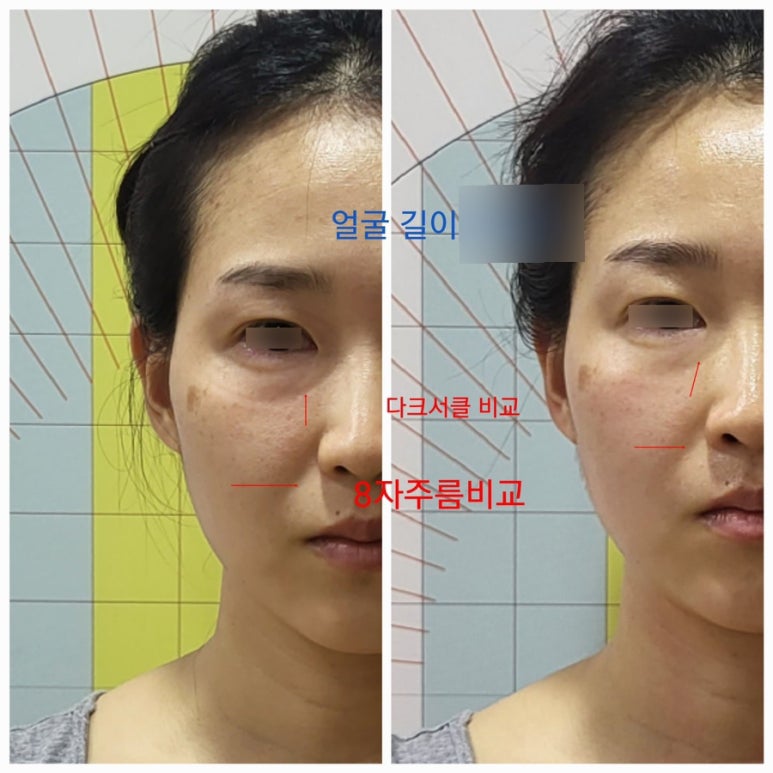타임에스테틱 이미지