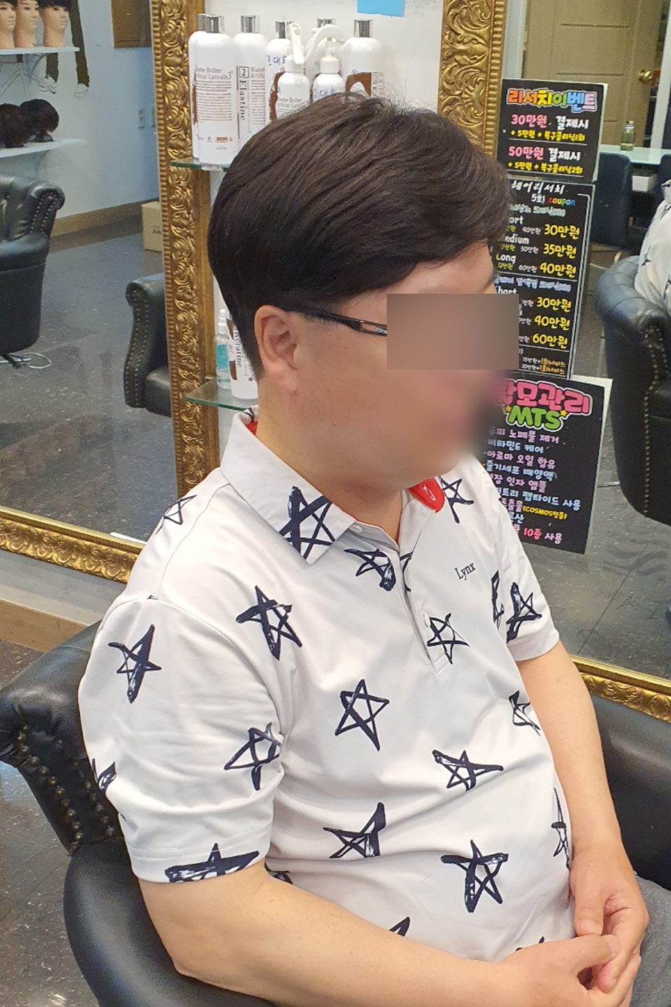 김호증모가발by헤어리서치 이미지