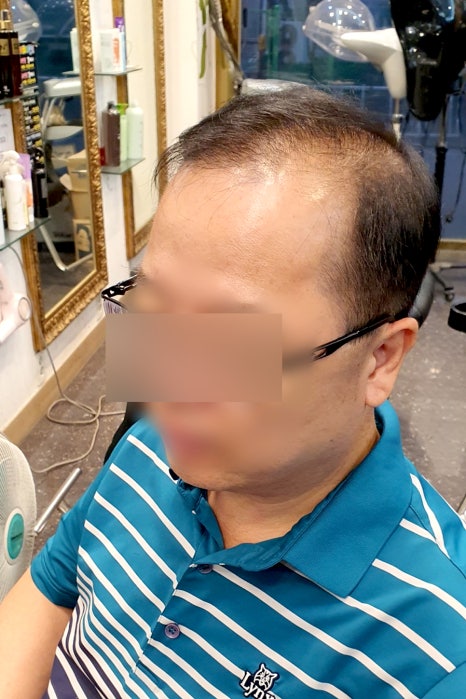 김호증모가발by헤어리서치 이미지