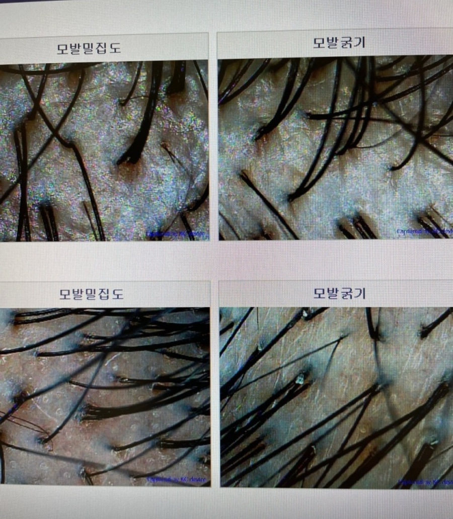 모바이오 이미지