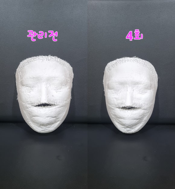 희스킨 이미지