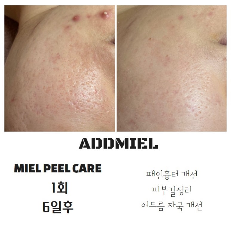 필애드 이미지