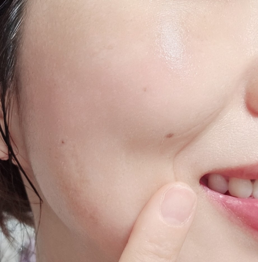 진피오니 이미지